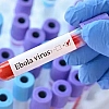 Во Франции выявили первый случай заражения вирусом Эбола