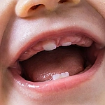 Высокий стресс у беременных ускоряет прорезывание молочных зубов у детей