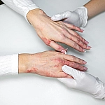 Ученые связали стресс с обострением экземы