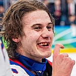 Хоккеист Джек Хьюз восстановил зуб, выбитый на Олимпиаде-2026