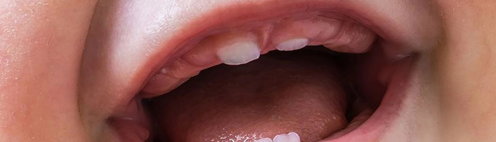 Высокий стресс у беременных ускоряет прорезывание молочных зубов у детей