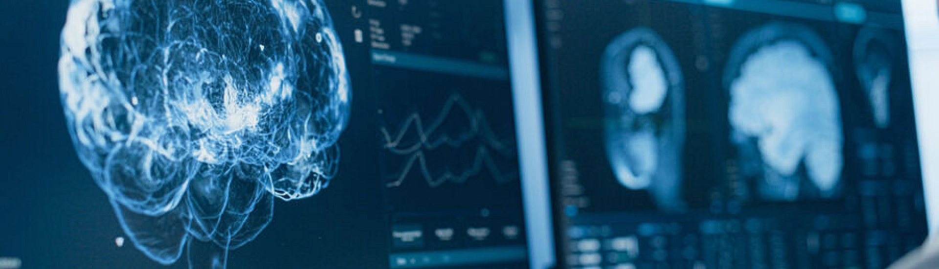 Ученые связали загрязнение воздуха с повышенным риском развития БАС