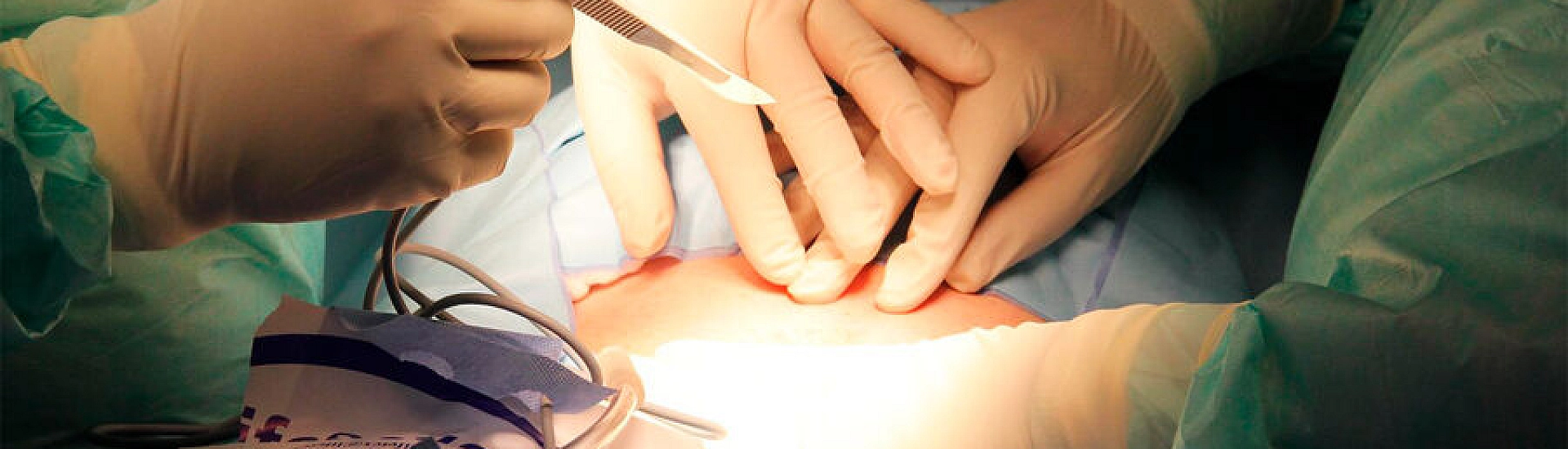 В Дагестане пенсионерка четыре года жила с салфеткой в животе после операции