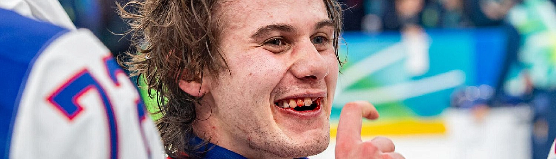 Хоккеист Джек Хьюз восстановил зуб, выбитый на Олимпиаде-2026