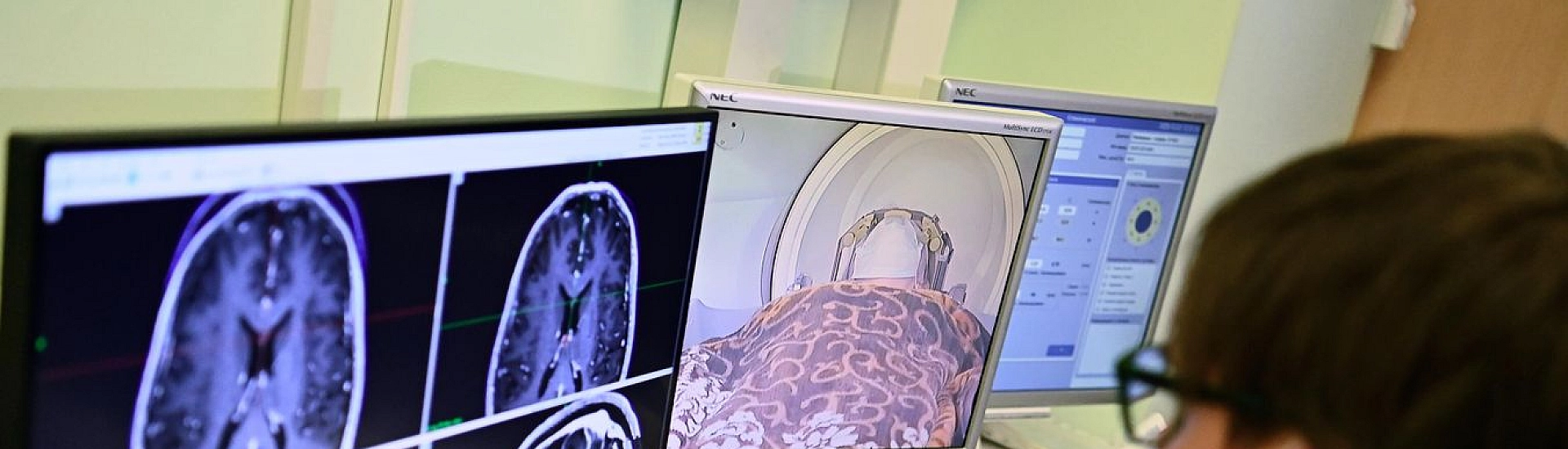 «Раковое цунами»: почему число онкологических заболеваний в мире будет расти и как снизить риски