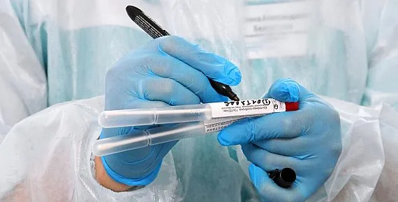 В России зарегистрировали более 614 тысяч случаев ОРВИ, гриппа и COVID-19 за неделю
