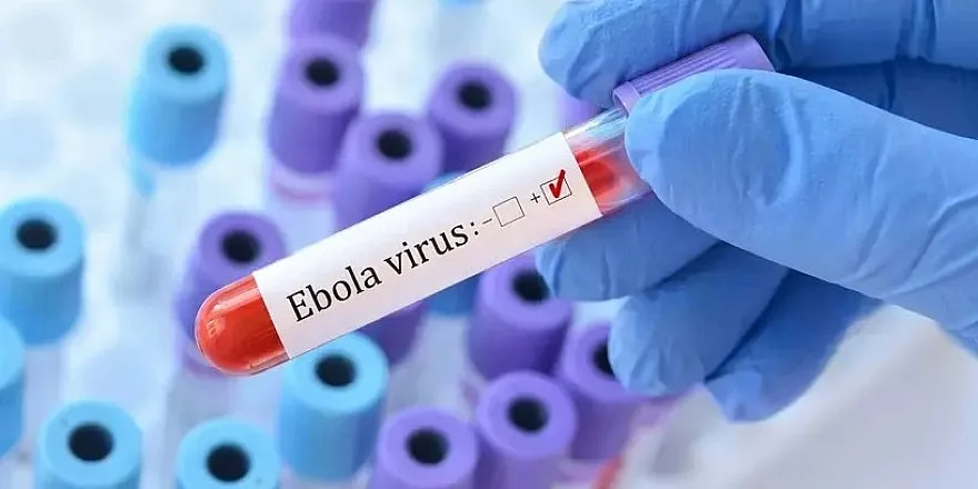 Во Франции выявили первый случай заражения вирусом Эбола